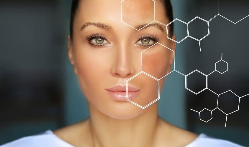 (Q&#038;A) NHỮNG CÁCH LÀM GIẢM SẮC TỐ DA