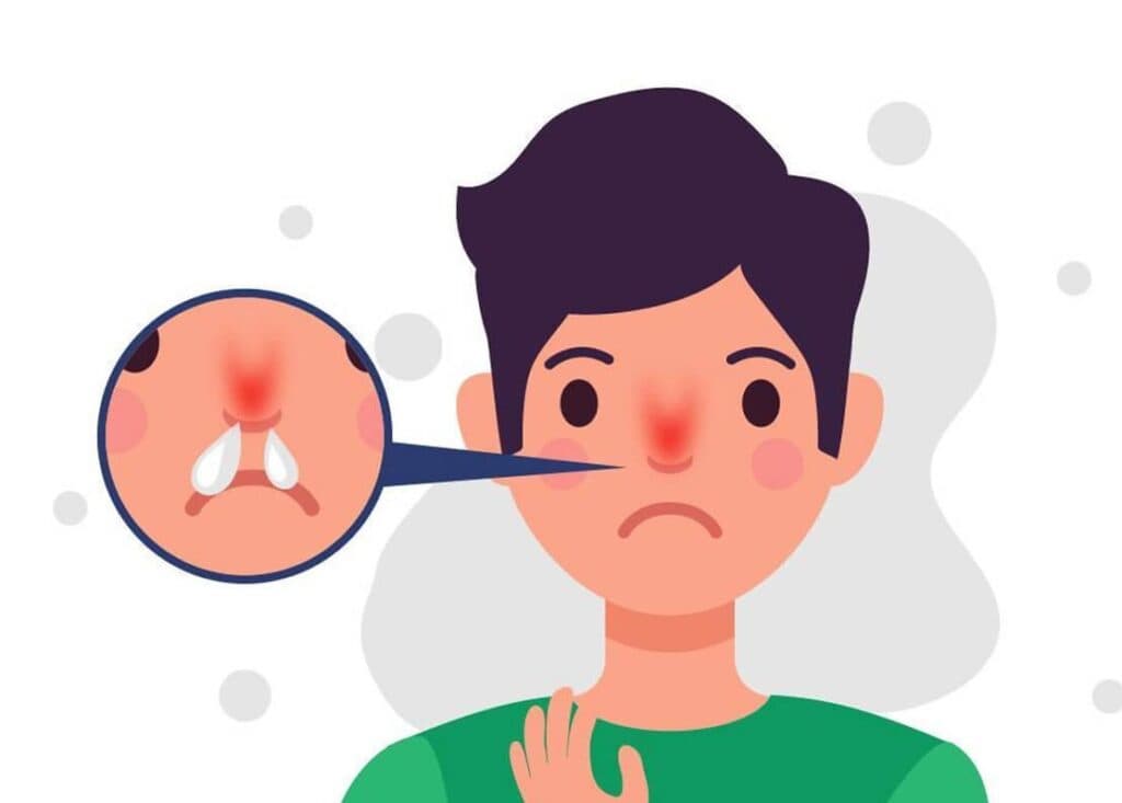 Nhận Biết Tình Trạng Sức Khỏe Qua Màu Sắc Dịch Mũi